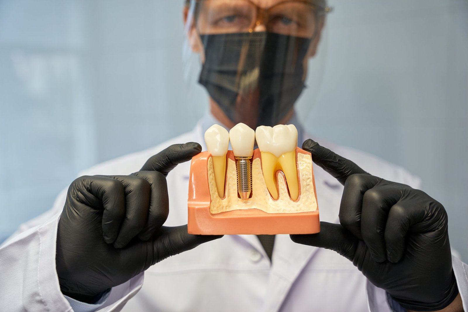 Implantes-Dentario