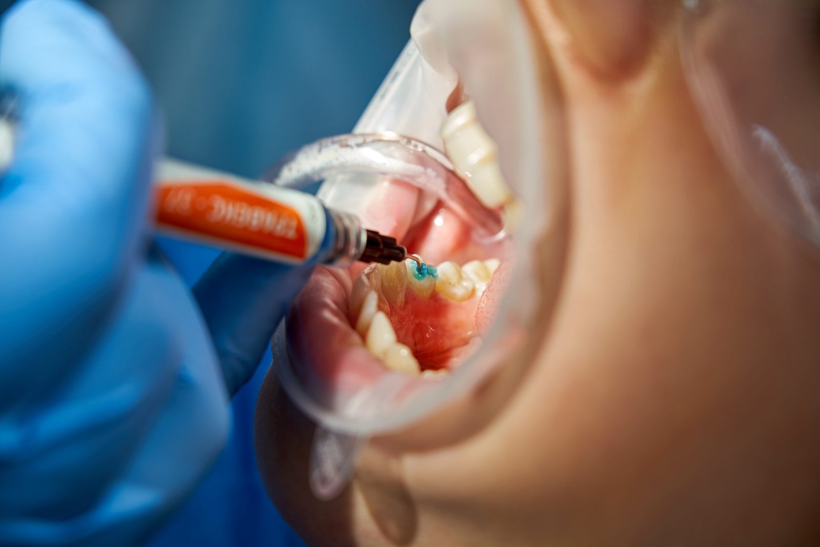 Periodontista-Perto-De-Mim