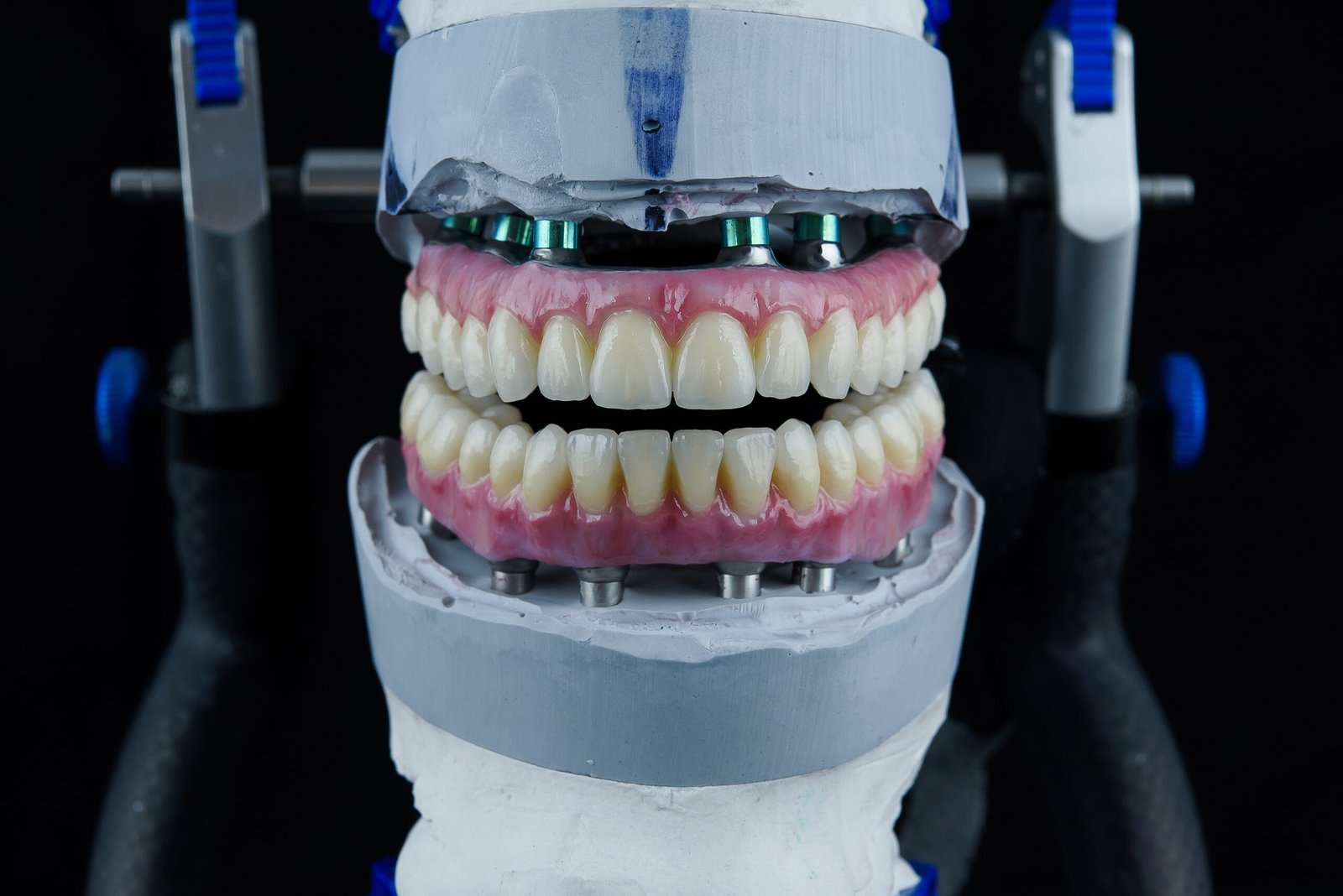 Protese-Dentista